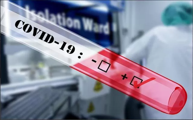 В Таджикистане обнаружено 39 новых случаев инфицирования COVID-19 В Таджикистане обнаружено 39 новых случаев инфицирования COVID-19
